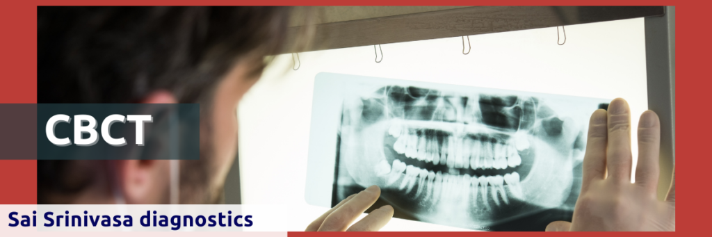 CBCT